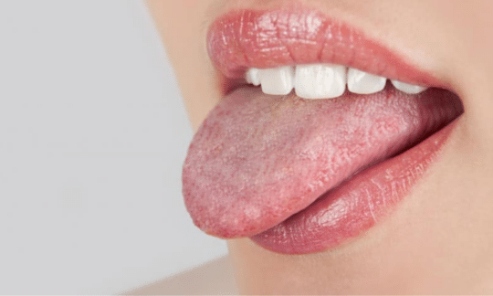 inflamed-taste-bud-pictures-causes-treatment-remedies