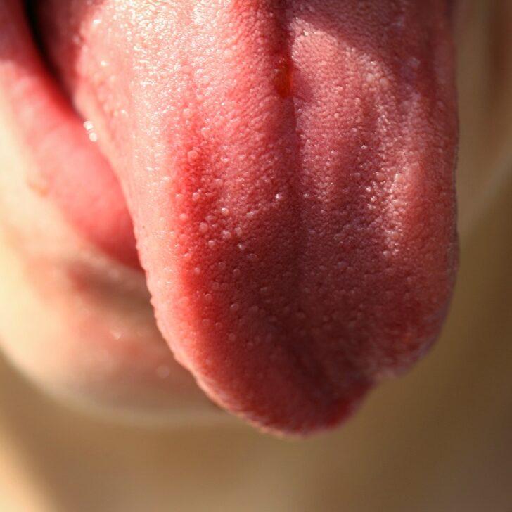 Why are My Taste Buds Swollen